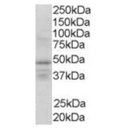 Western Blot - Anti-RXRG Antibody (A83406) - Antibodies.com