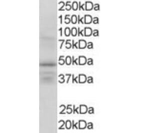 Western Blot - Anti-RXRG Antibody (A83406) - Antibodies.com