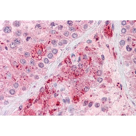 Immunohistochemistry - Anti-Rif1 Antibody (A83407) - Antibodies.com