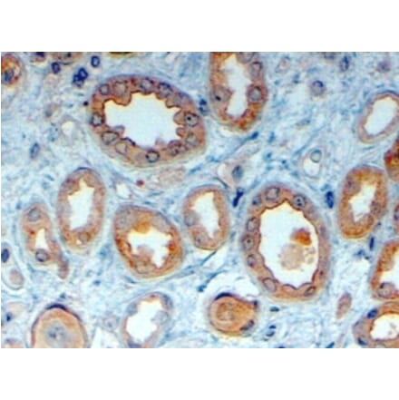 Immunohistochemistry - Anti-LRP6 Antibody (A83408) - Antibodies.com