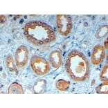 Immunohistochemistry - Anti-LRP6 Antibody (A83408) - Antibodies.com