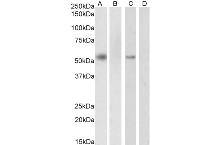 Western Blot - Anti-RXRA Antibody (A83409) - Antibodies.com