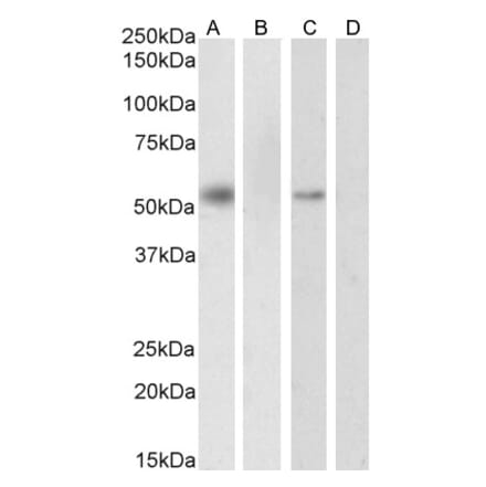 Western Blot - Anti-RXRA Antibody (A83409) - Antibodies.com