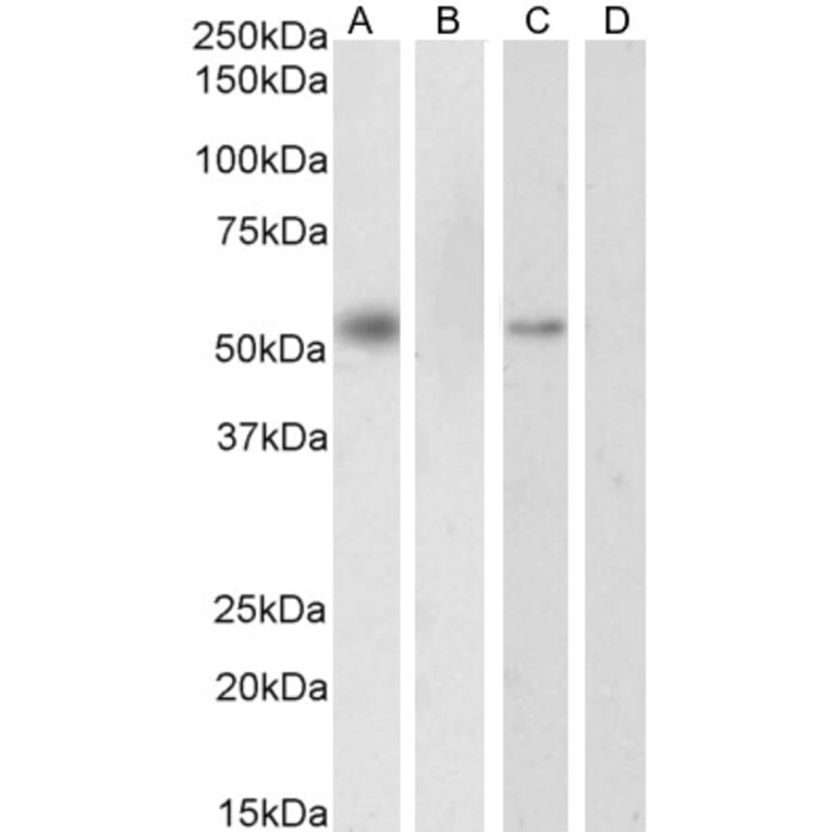Western Blot - Anti-RXRA Antibody (A83409) - Antibodies.com