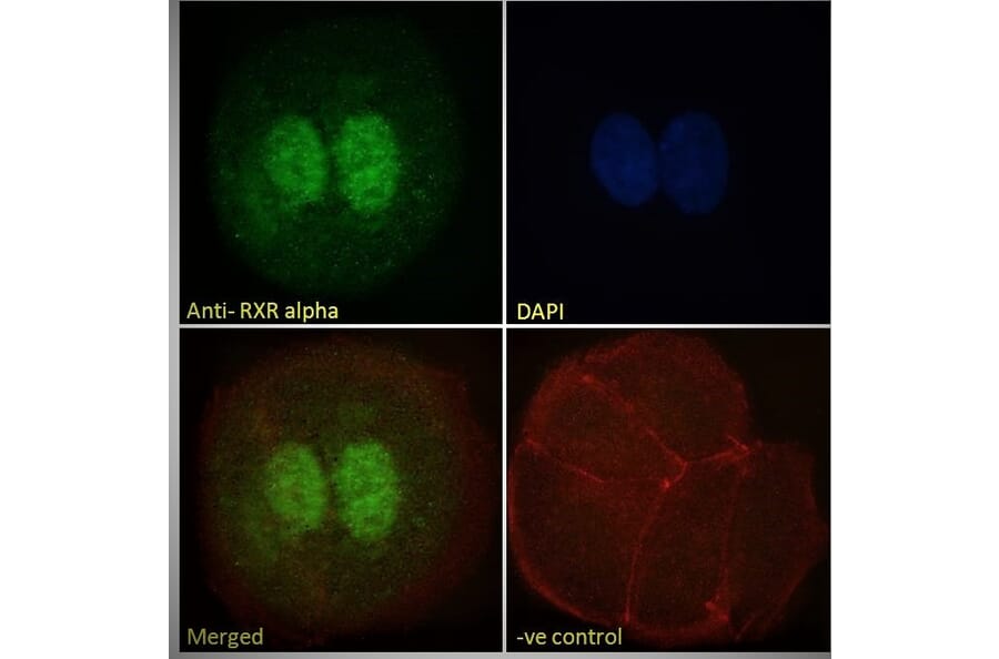 Immunofluorescence - Anti-RXRA Antibody (A83409) - Antibodies.com