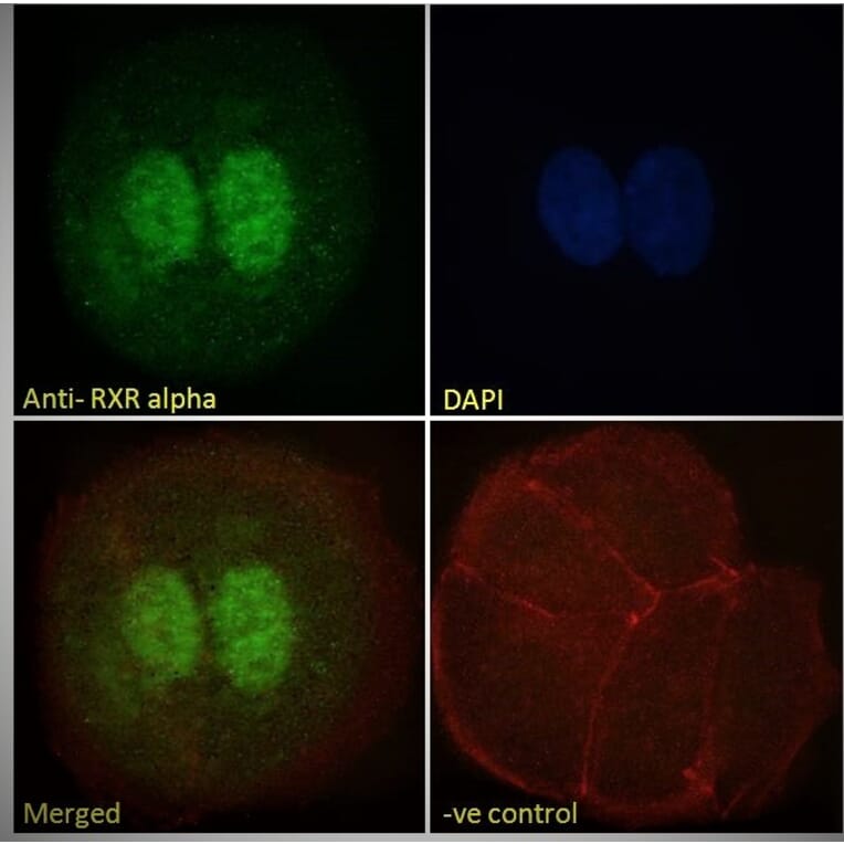 Immunofluorescence - Anti-RXRA Antibody (A83409) - Antibodies.com