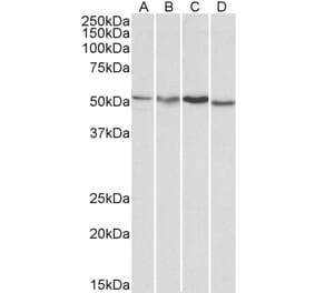 Western Blot - Anti-AKT3 Antibody (A83410) - Antibodies.com