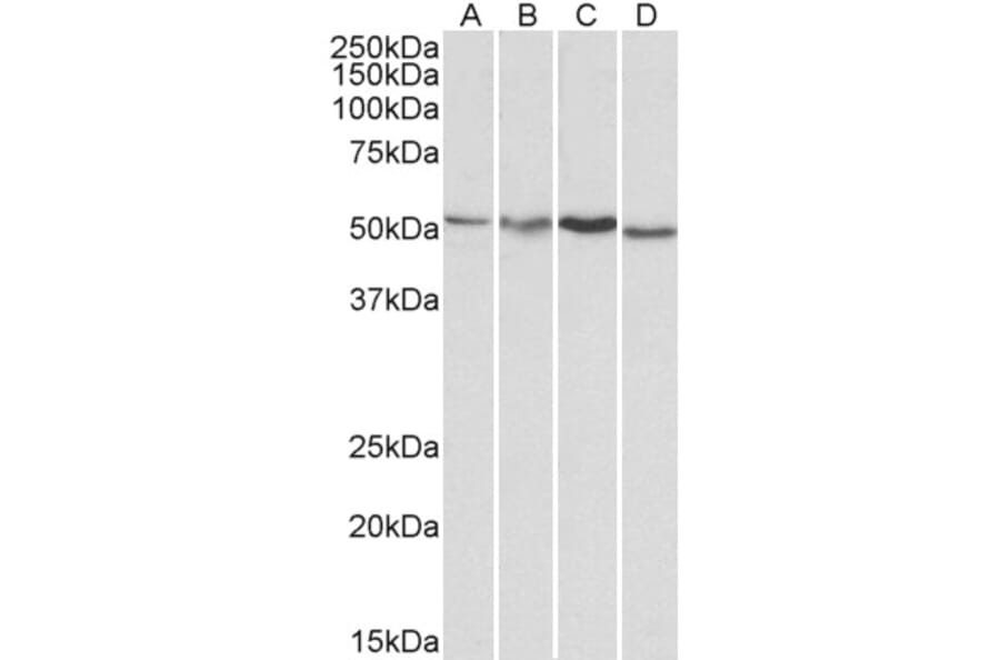 Western Blot - Anti-AKT3 Antibody (A83410) - Antibodies.com
