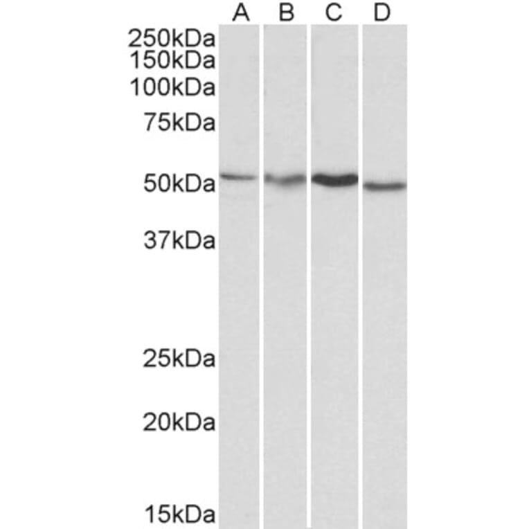 Western Blot - Anti-AKT3 Antibody (A83410) - Antibodies.com
