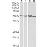 Western Blot - Anti-AKT3 Antibody (A83410) - Antibodies.com