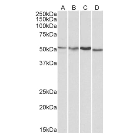 Western Blot - Anti-AKT3 Antibody (A83410) - Antibodies.com