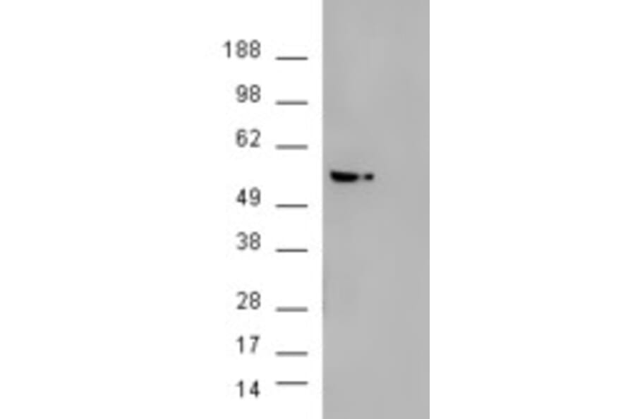 Western Blot - Anti-AKT3 Antibody (A83410) - Antibodies.com