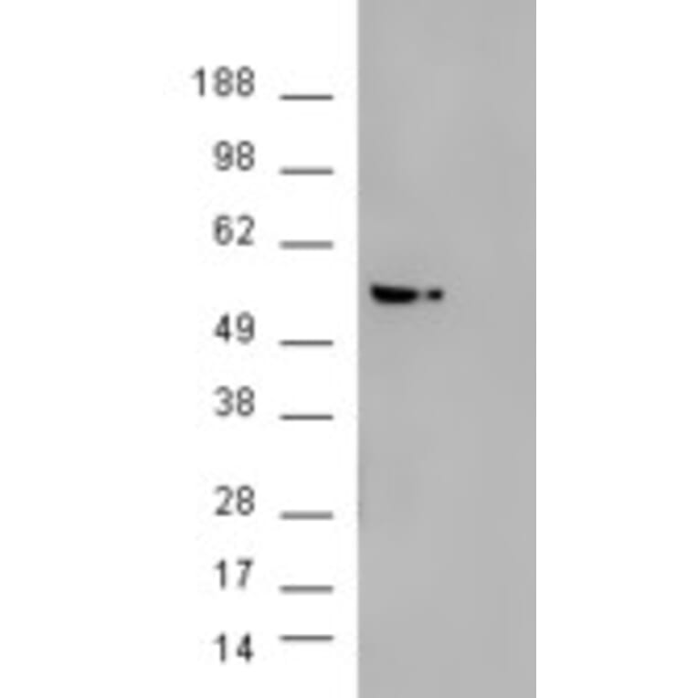 Western Blot - Anti-AKT3 Antibody (A83410) - Antibodies.com
