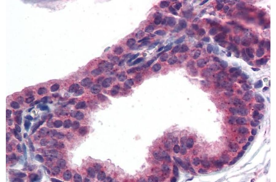 Immunohistochemistry - Anti-AKT3 Antibody (A83410) - Antibodies.com
