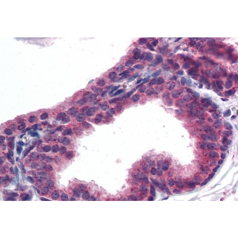 Immunohistochemistry - Anti-AKT3 Antibody (A83410) - Antibodies.com