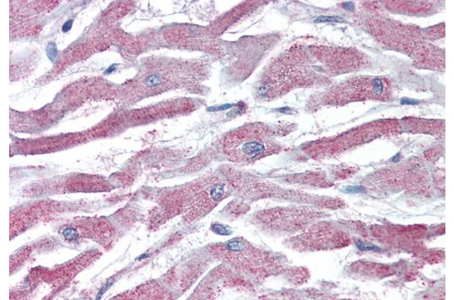 Immunohistochemistry - Anti-AKT3 Antibody (A83410) - Antibodies.com