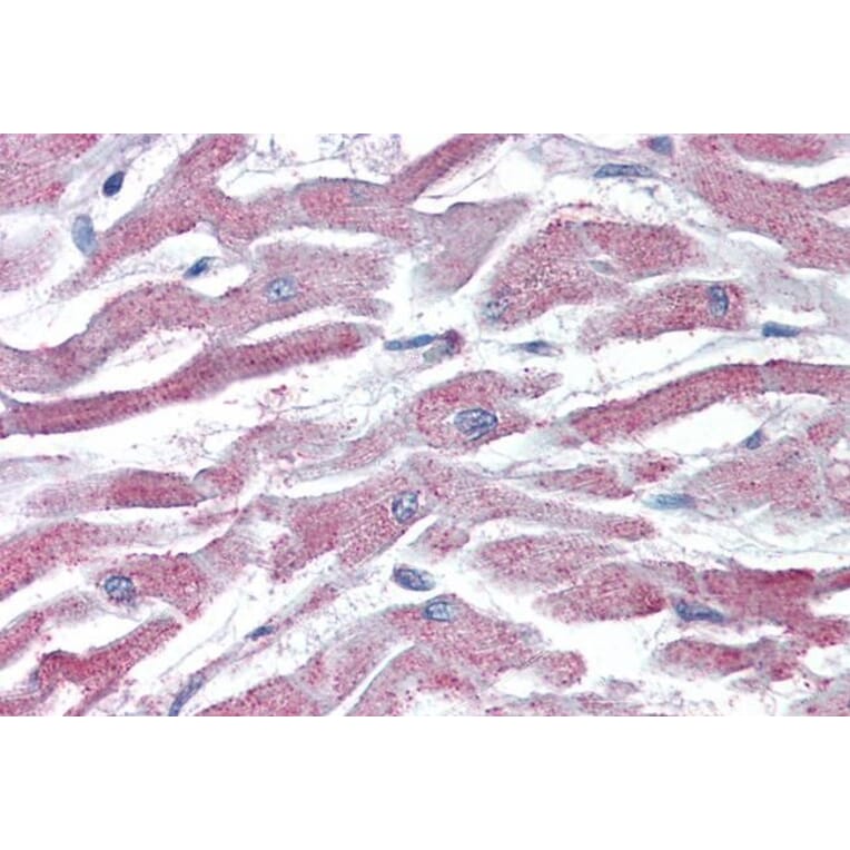 Immunohistochemistry - Anti-AKT3 Antibody (A83410) - Antibodies.com