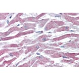 Immunohistochemistry - Anti-AKT3 Antibody (A83410) - Antibodies.com