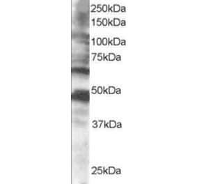 Western Blot - Anti-CPEB1 Antibody (A83411) - Antibodies.com