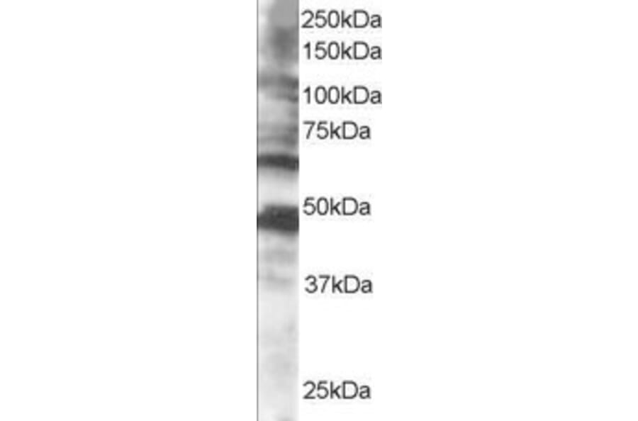 Western Blot - Anti-CPEB1 Antibody (A83411) - Antibodies.com