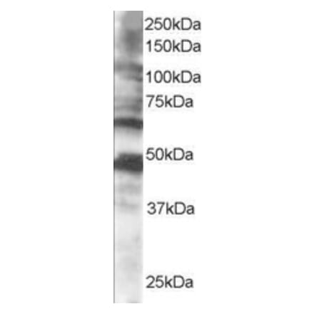 Western Blot - Anti-CPEB1 Antibody (A83411) - Antibodies.com