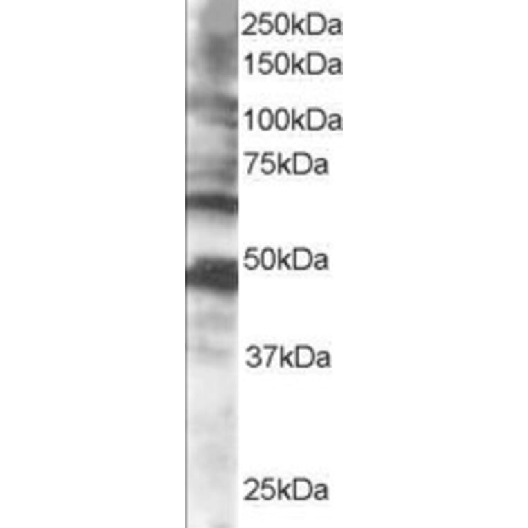 Western Blot - Anti-CPEB1 Antibody (A83411) - Antibodies.com