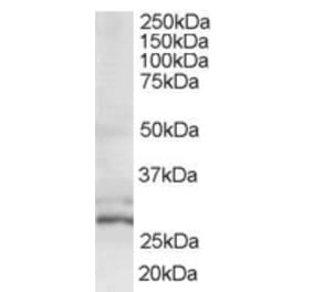 Western Blot - Anti-TIP30 Antibody (A83412) - Antibodies.com