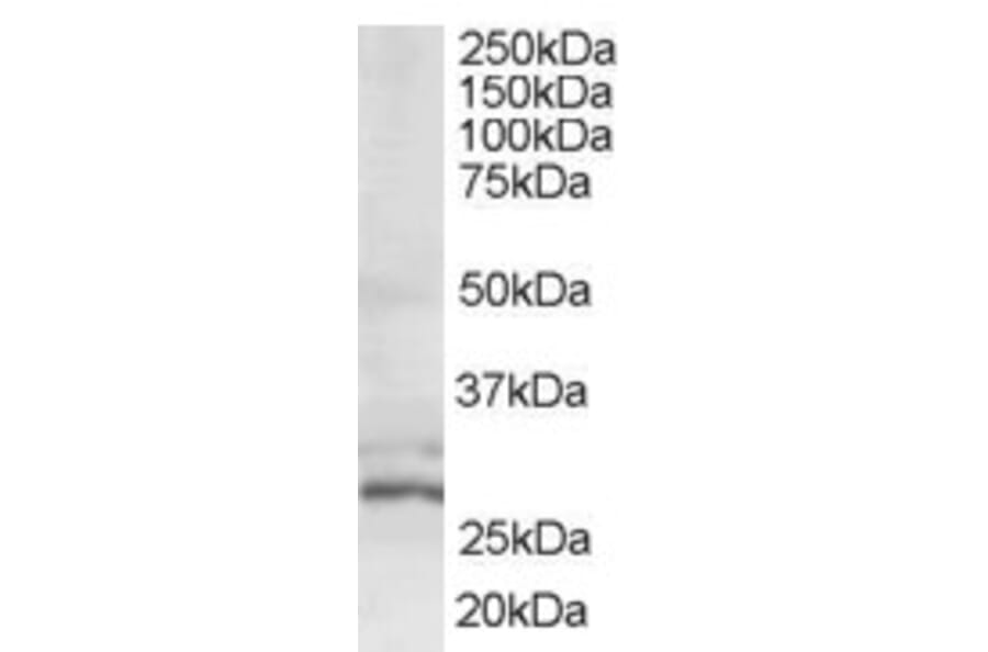 Western Blot - Anti-TIP30 Antibody (A83412) - Antibodies.com