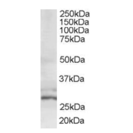 Western Blot - Anti-TIP30 Antibody (A83412) - Antibodies.com