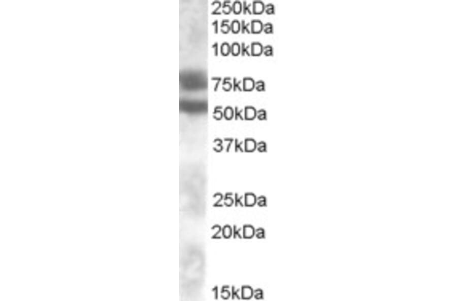 Western Blot - Anti-DACH1 Antibody (A83413) - Antibodies.com
