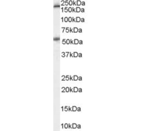 Western Blot - Anti-HTR3A Antibody (A83414) - Antibodies.com
