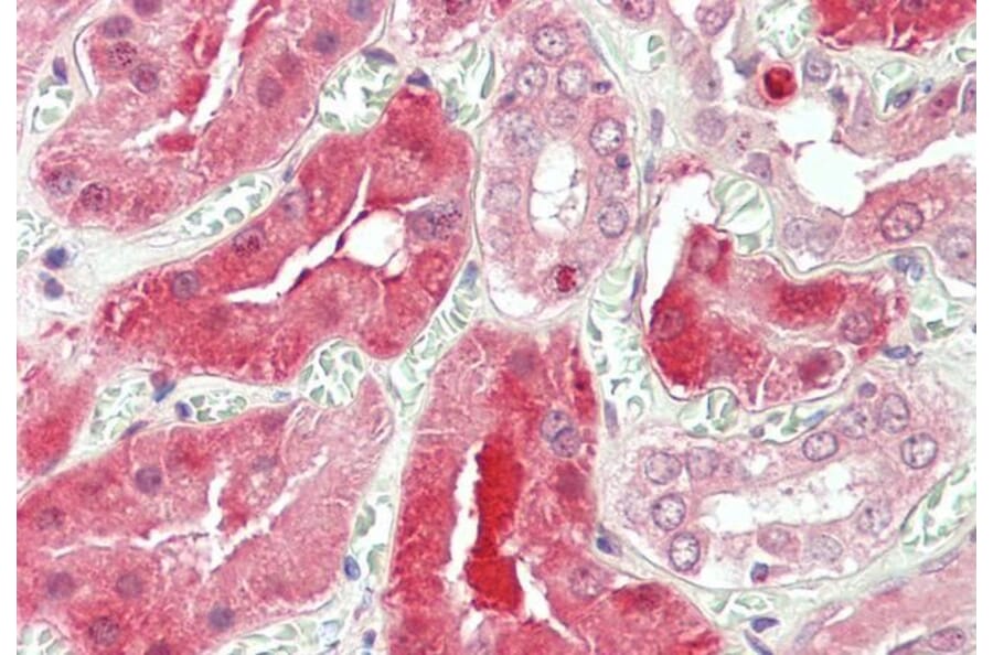 Immunohistochemistry - Anti-STAT3 Antibody (A83415) - Antibodies.com