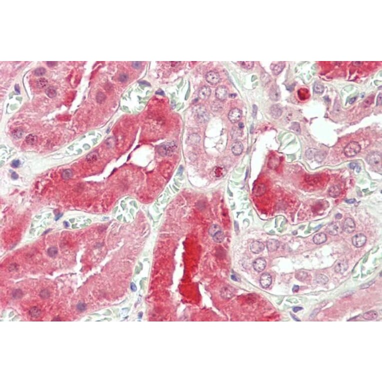 Immunohistochemistry - Anti-STAT3 Antibody (A83415) - Antibodies.com