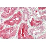 Immunohistochemistry - Anti-STAT3 Antibody (A83415) - Antibodies.com