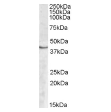 Western Blot - Anti-SPHK1 Antibody (A83416) - Antibodies.com