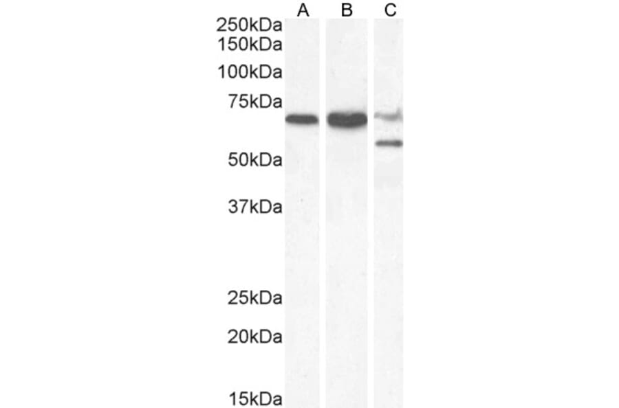 Western Blot - Anti-PPP2R5D Antibody (A83418) - Antibodies.com
