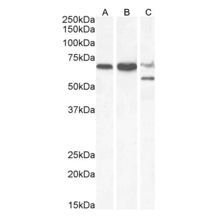 Western Blot - Anti-PPP2R5D Antibody (A83418) - Antibodies.com