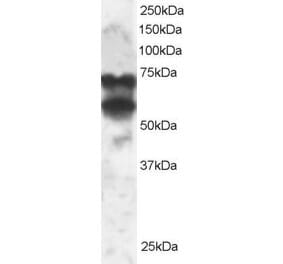 Western Blot - Anti-PPP2R5D Antibody (A83418) - Antibodies.com