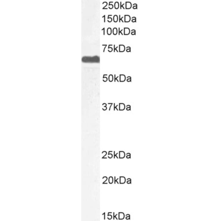 Western Blot - Anti-PPP2R5D Antibody (A83418) - Antibodies.com