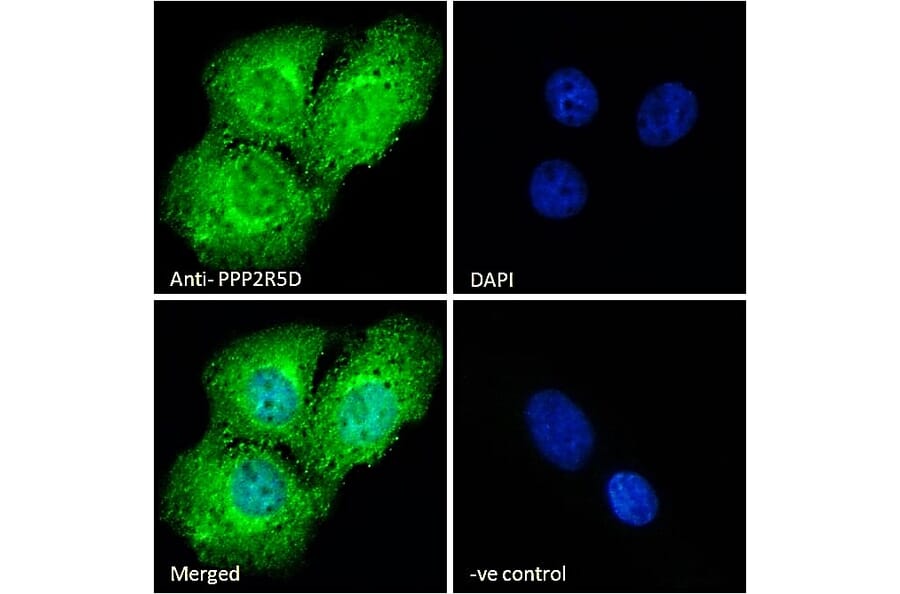 Immunofluorescence - Anti-PPP2R5D Antibody (A83418) - Antibodies.com