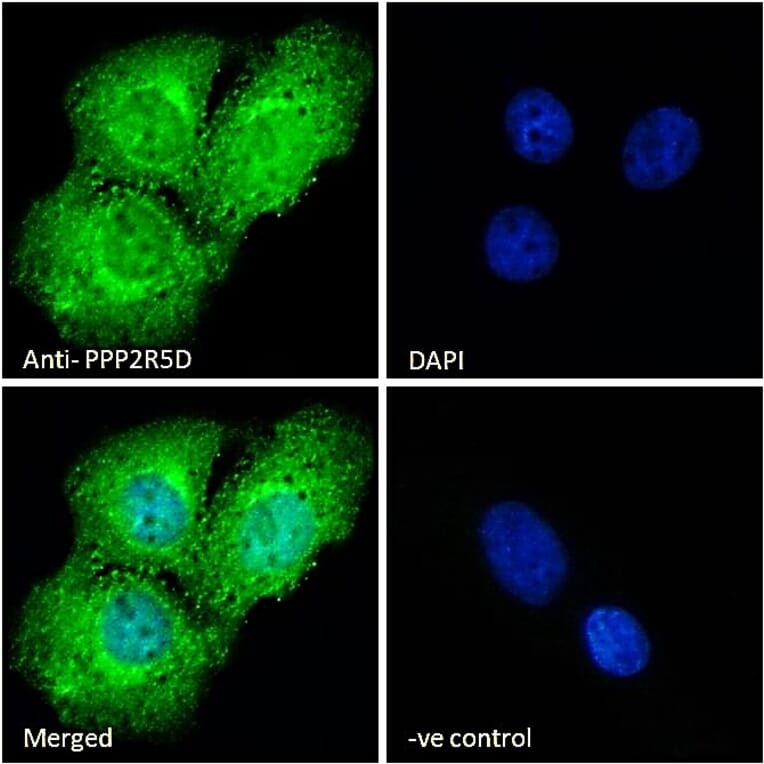 Immunofluorescence - Anti-PPP2R5D Antibody (A83418) - Antibodies.com