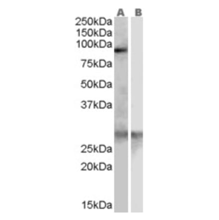 Western Blot - Anti-SREC-I Antibody (A83419) - Antibodies.com