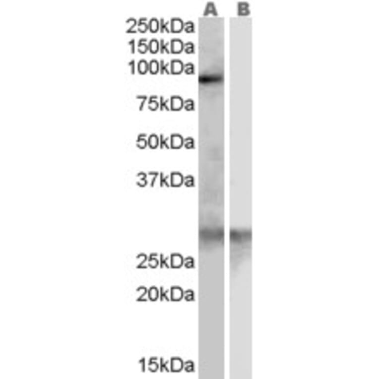 Western Blot - Anti-SREC-I Antibody (A83419) - Antibodies.com