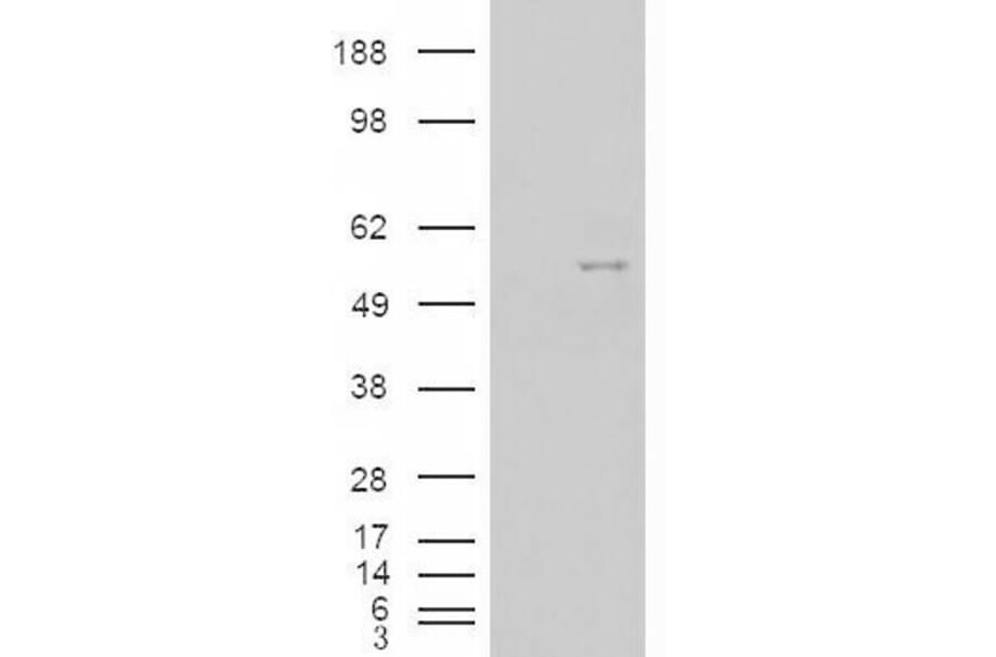 Western Blot - Anti-Nova1 Antibody (A83421) - Antibodies.com