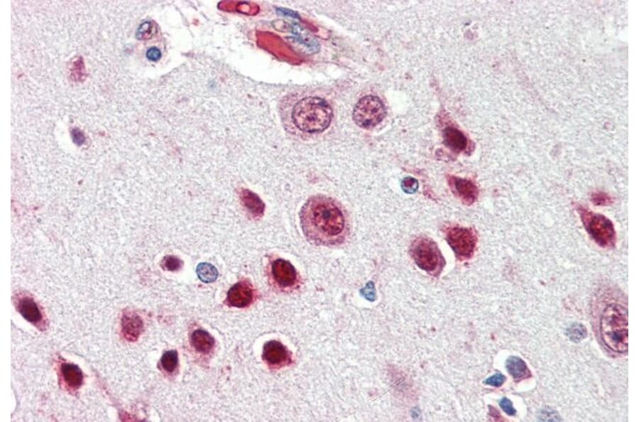 Immunohistochemistry - Anti-Nova1 Antibody (A83421) - Antibodies.com
