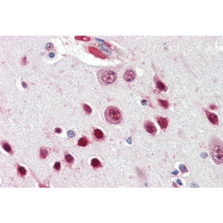 Immunohistochemistry - Anti-Nova1 Antibody (A83421) - Antibodies.com