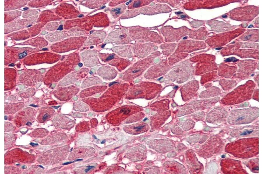 Immunohistochemistry - Anti-Nova1 Antibody (A83421) - Antibodies.com