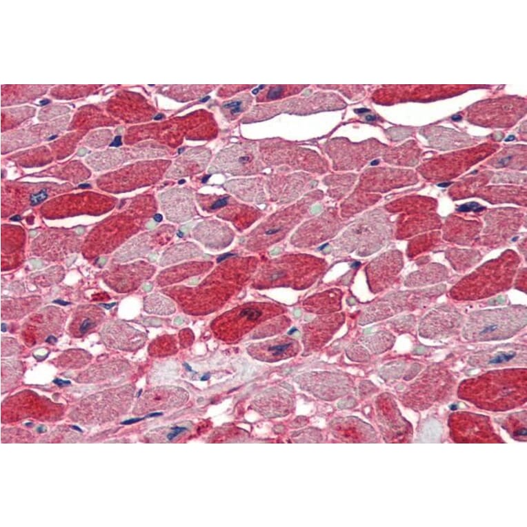 Immunohistochemistry - Anti-Nova1 Antibody (A83421) - Antibodies.com