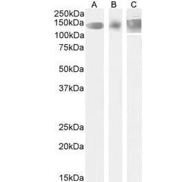 Western Blot - Anti-Leptin Receptor Antibody (A83422) - Antibodies.com