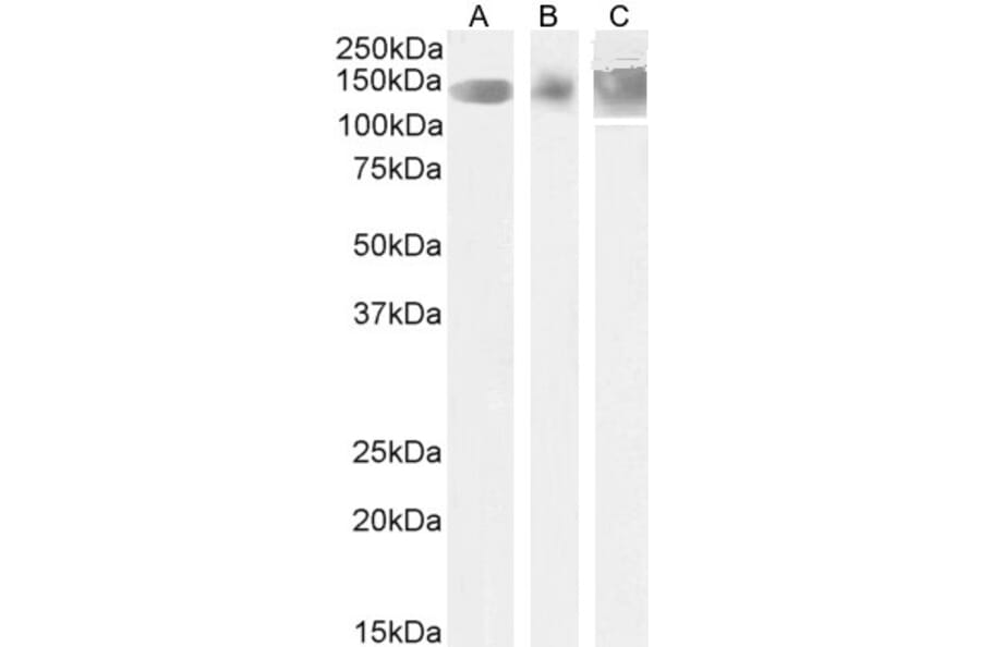 Western Blot - Anti-Leptin Receptor Antibody (A83422) - Antibodies.com